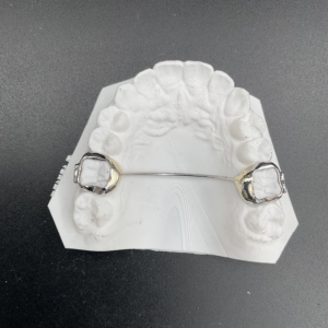 Trans Palatal Arch