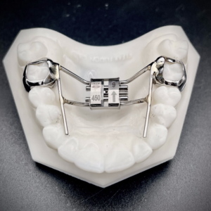 Leone Leaf Expander