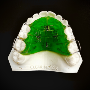 Sagittal