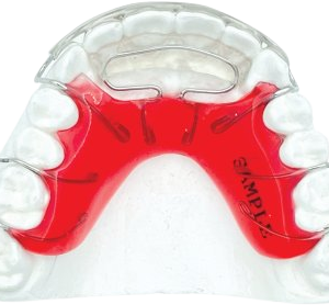 Modified Spring Retainer Plus with Adams
