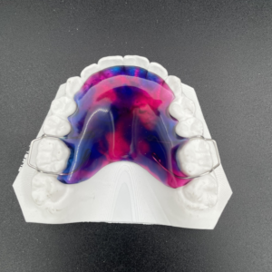 Maxillary Biteplate Adams Clasps