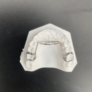 Custom Fixed Tongue Guard