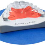 Spring Aligners