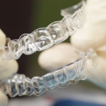 Removable Appliance
