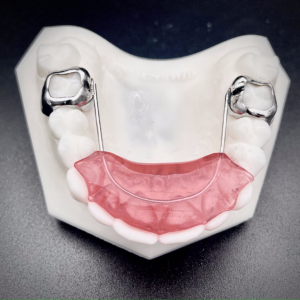 Fixed Bite Plate