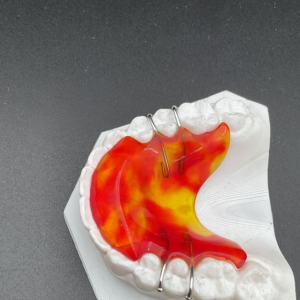 Biteplate 4 Clasps