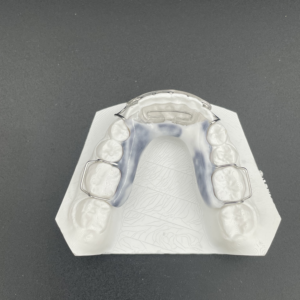 Maxillary/Mandibular Modified Spring Retainer Plus - Image 3