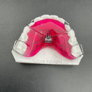 3 Way Expander