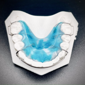 Maxillary Hawley with Adams