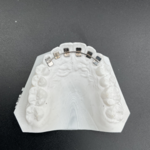 Krause fixed Retainer (per mesh pad)