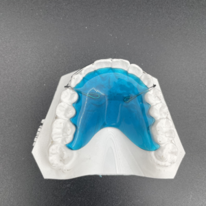 Maxillary 3-3 Hawley with no Clasps