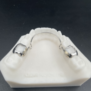 6x6 Mandibular Lingual Holding Arch w/ Omega Expansion