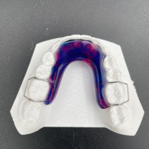 Maxillary/Mandibular Plate w/ 2 Clasps