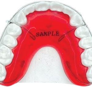 Continues Full Labial with Support Wires