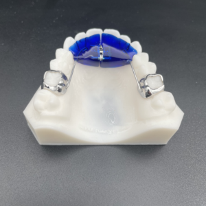Fixed Anterior Expander