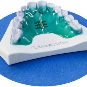 Clear Fusion Hybrid Retainer with Midline