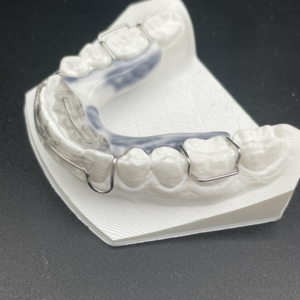 Maxillary/Mandibular Modified Spring Retainer Plus