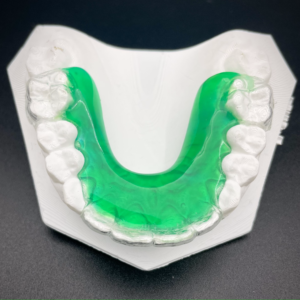 Phase 1 Hybrid Retainer