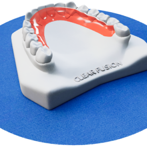 Mandibular Hawley with Ball Clasps