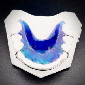 Maxillary Hawley with Ball Clasps