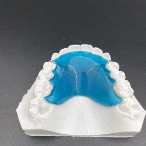 Maxillary 3-3 Hawley with no Clasps - Image 3